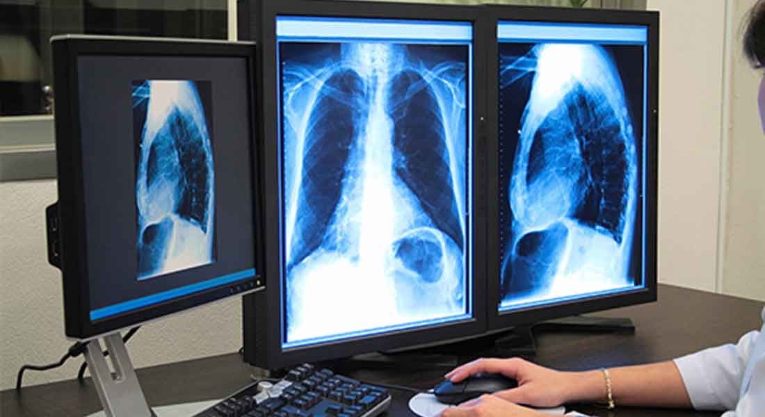 Diploma-in-X-Ray-&-Imaging-Technology-nashik